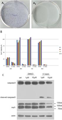 Regulation of the EGFR Pathway by HSP90 Is Involved in the Pathogenesis of Cushing’s Disease